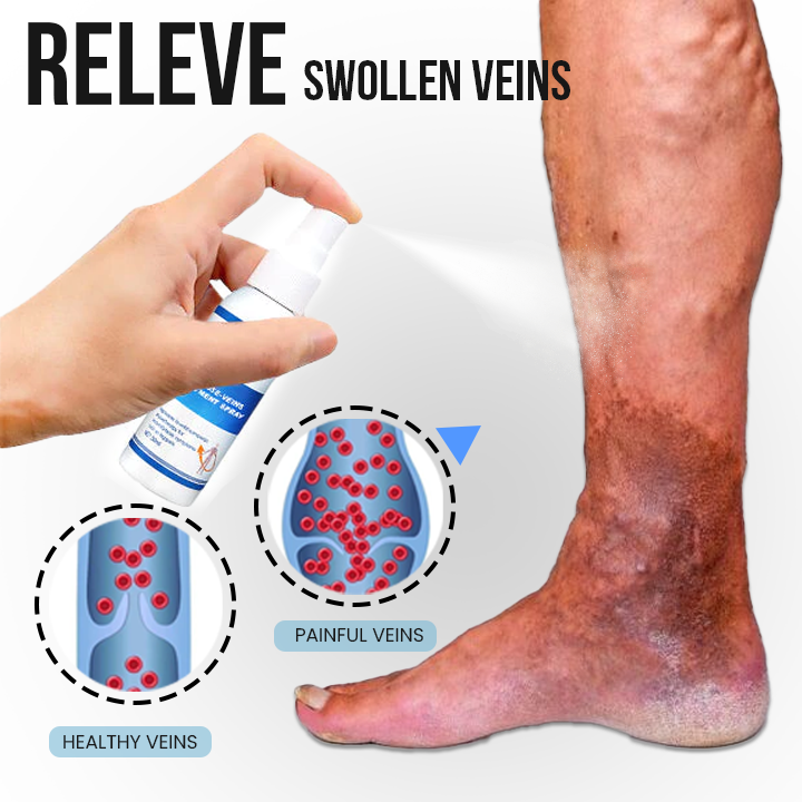 VeinDefense™ Varicose Treatment Spray