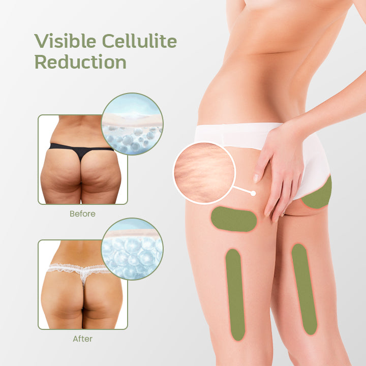 SmoothSHAPE™ Cellulite Reduction Herbal Patches