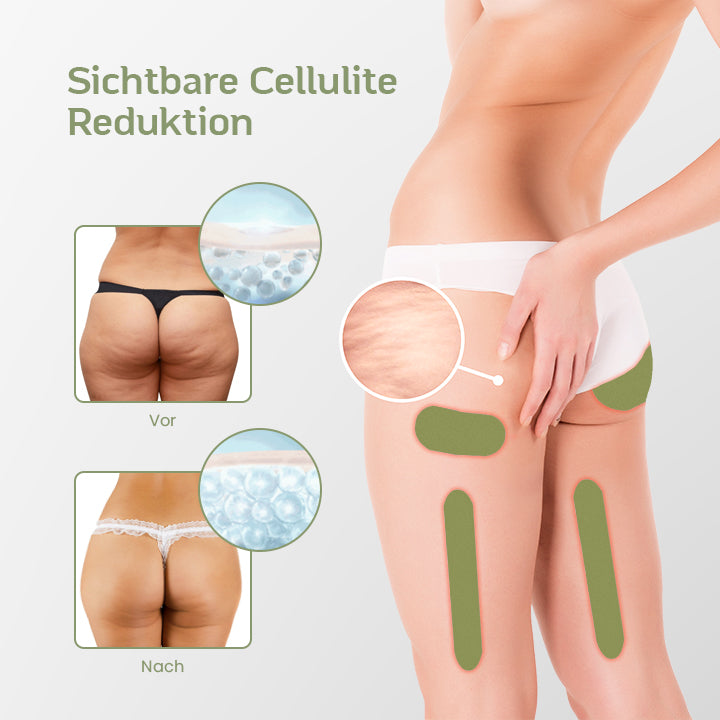 SmoothSHAPE™ Cellulite-Reduktions-Kräuterpflaster