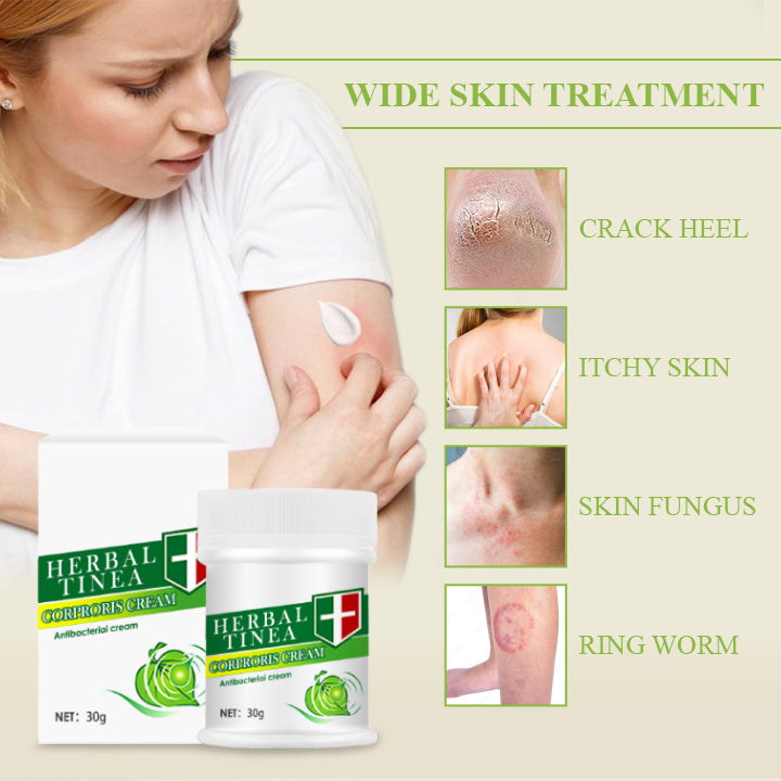 TineaCure™ Antifungal Cream