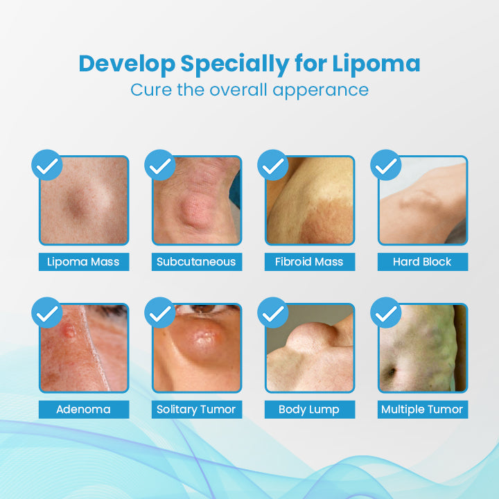 HEALumps™ Lipoma Treatment Ointment