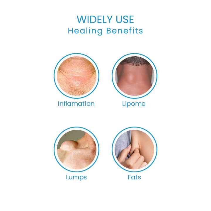 LumpFree Lipoma Removal Cream