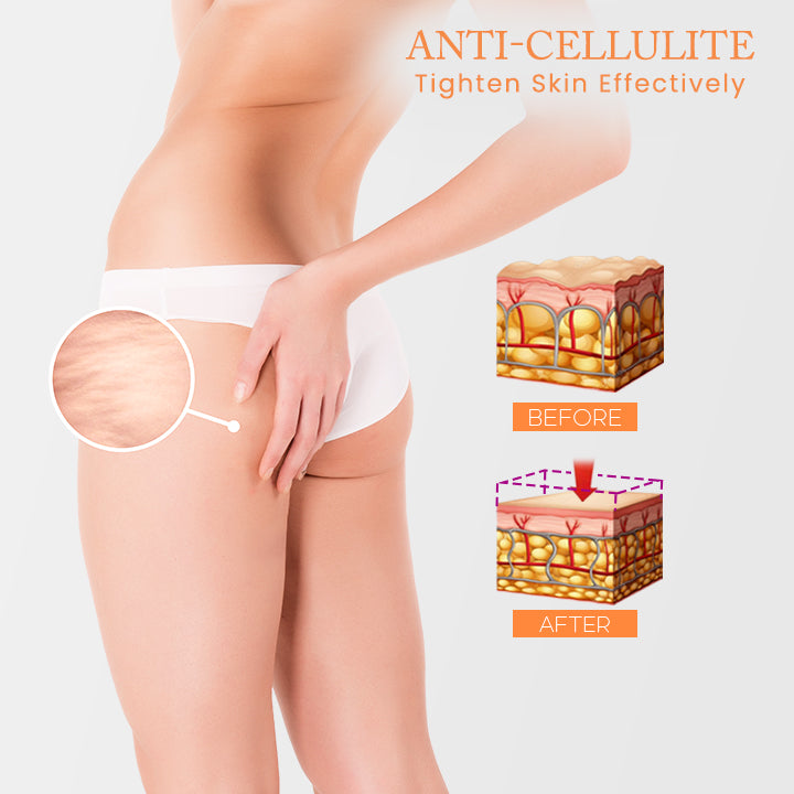 Anti-Cellulite Heating Ginger Foot Patch