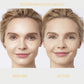 EyeLift™ Ionic Contouring System