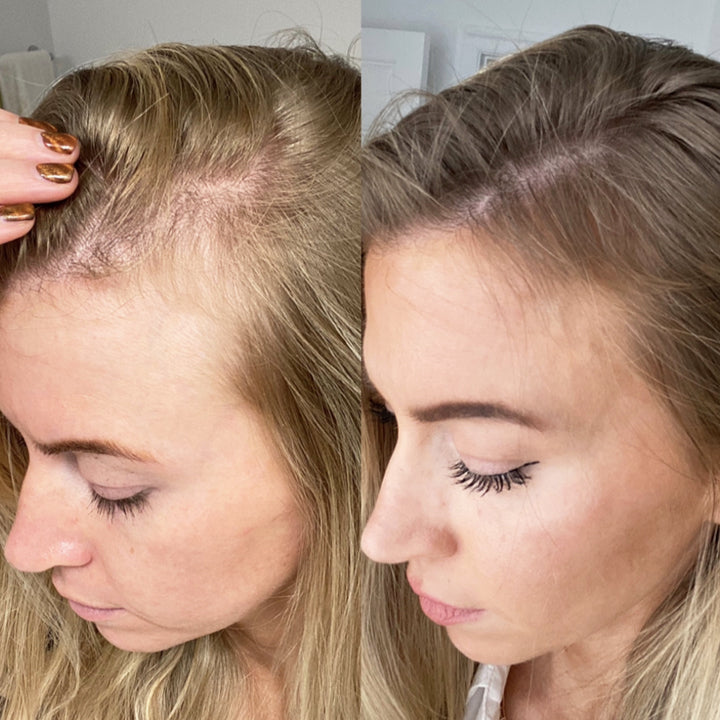 OriginPro Anti-Hair Loss Rice Shampoo Bar