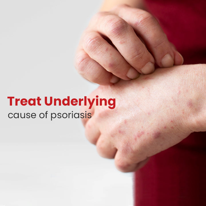 Kolmax™ Psoriasis Relief Spray