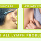 Lymphatic Herbal Detox Patch