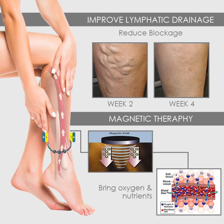 AntiSwell™ Obsidian Magnetic Therapy Anklet