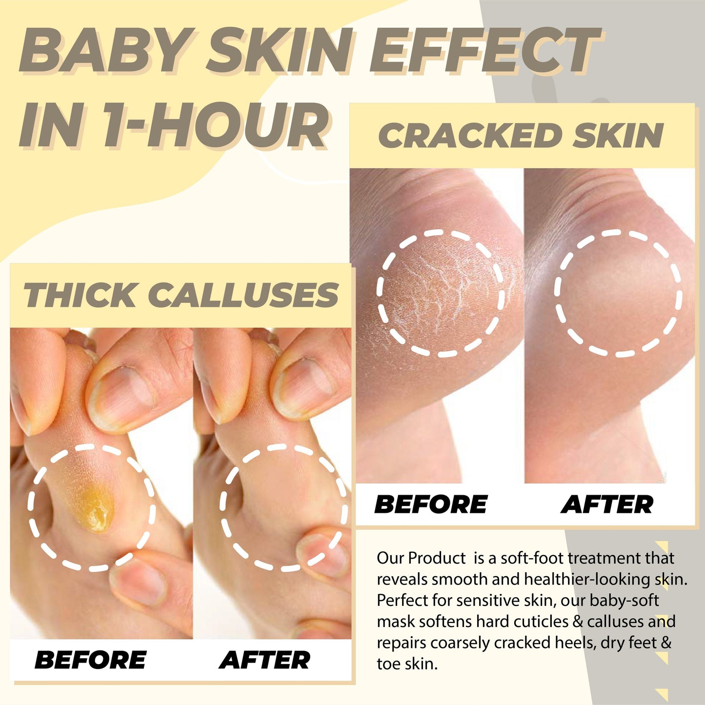 Moisturizing Foot Peeling Mask