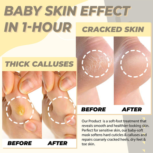 Moisturizing Foot Peeling Mask