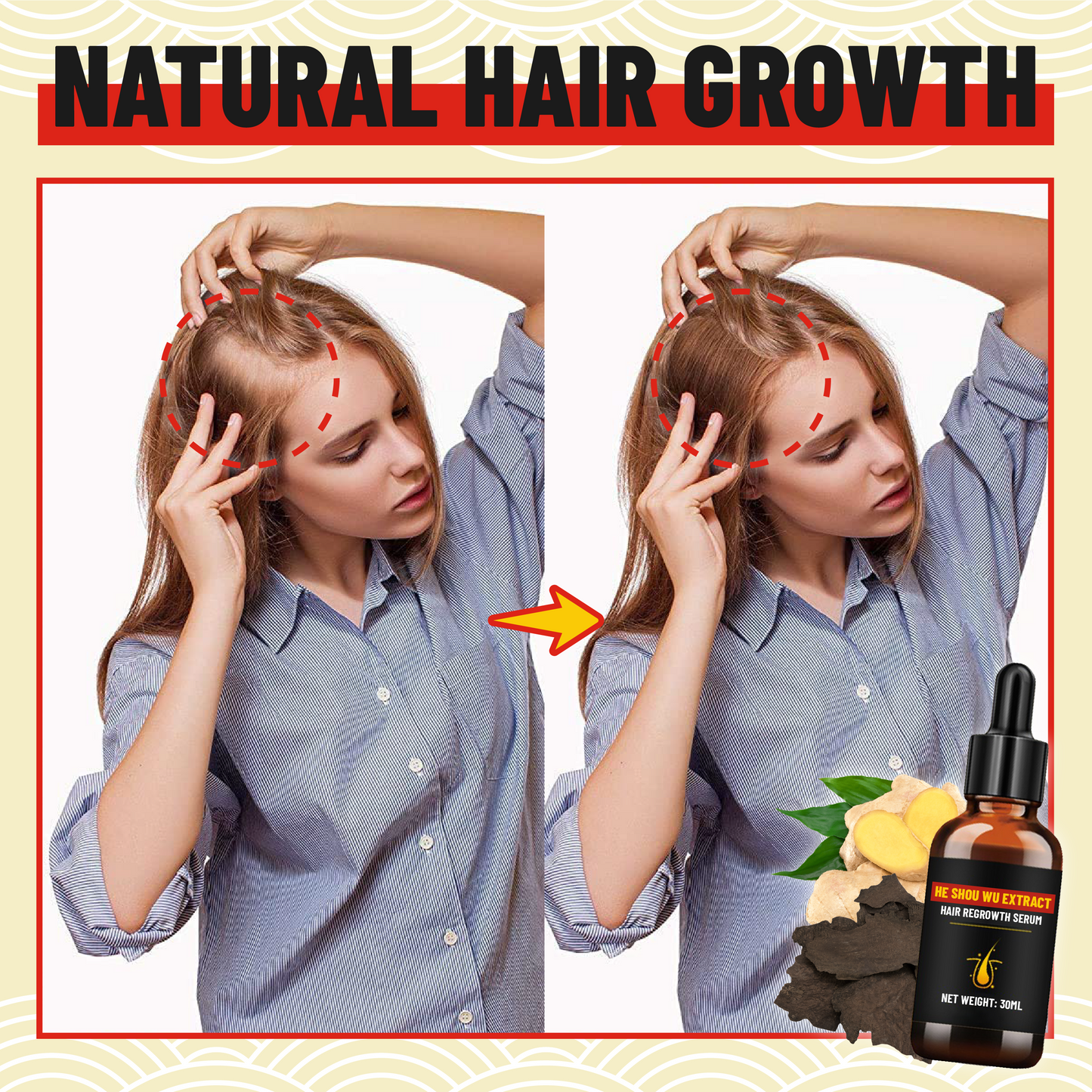 HeShouWu Extract Hair Regrowth Serum
