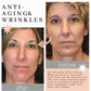Wrinkles-Killer Lifting Mask