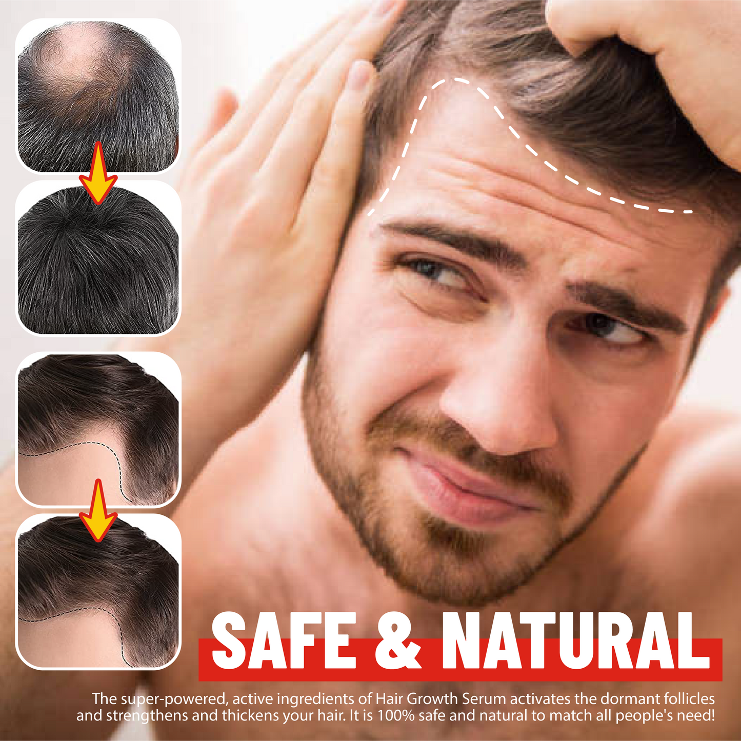 HeShouWu Extract Hair Regrowth Serum