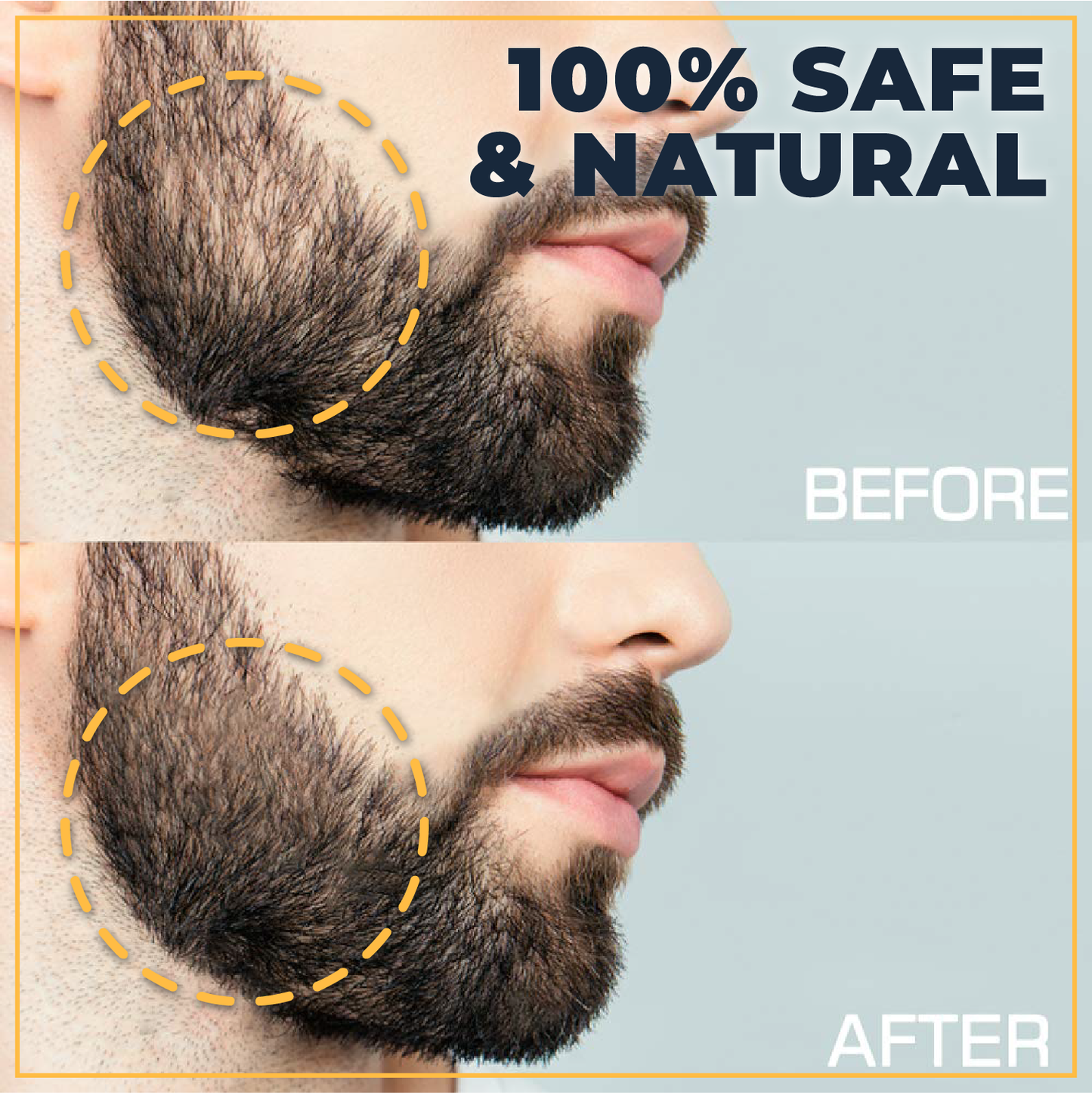 Hair+ Regrowing Essence & Roller Kit
