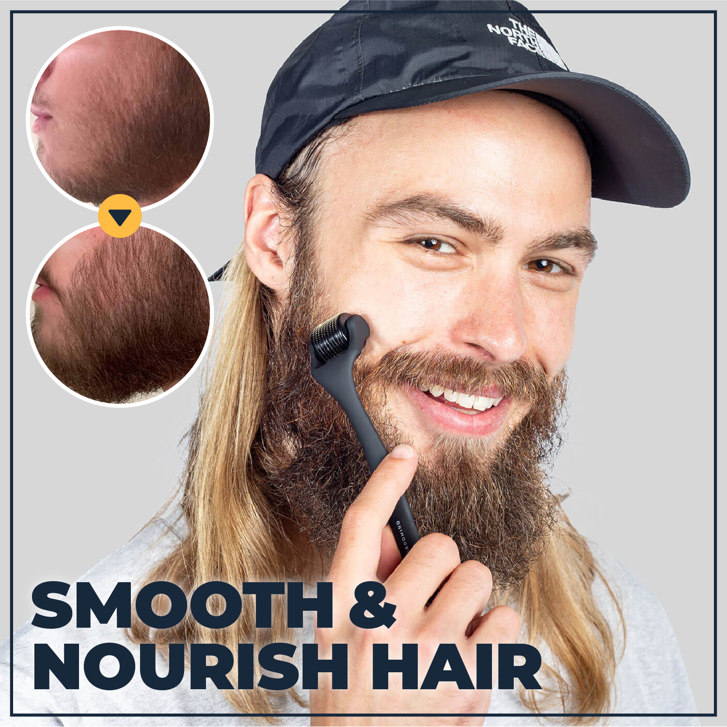 Hair+ Regrowing Essence & Roller Kit