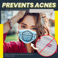 6D Breathable Silicone Bracket (4pcs)