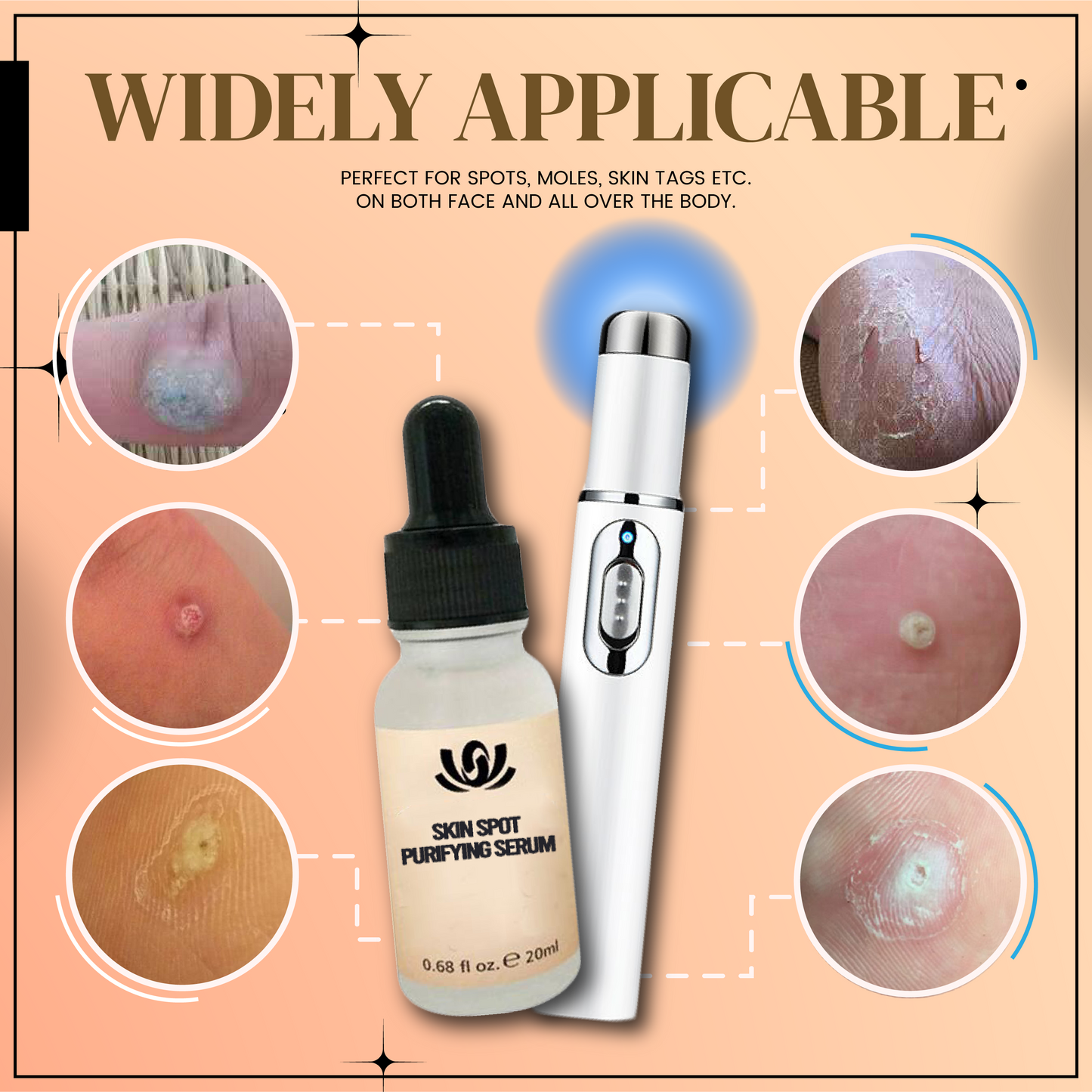 SpotsAttack™ Skin Renewing Set