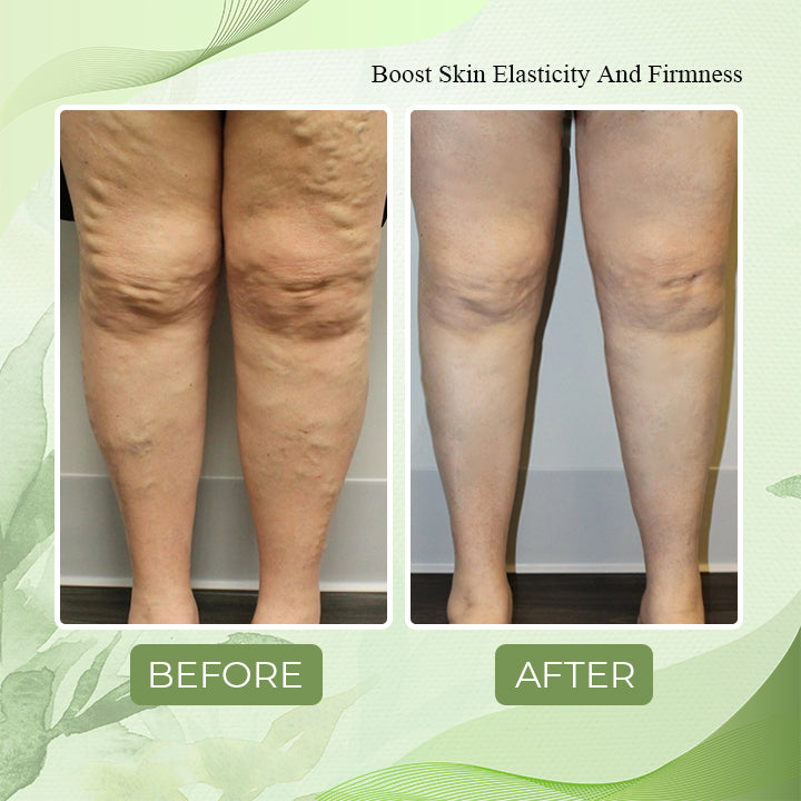 LymphaticDrainage Ginger FootPatch