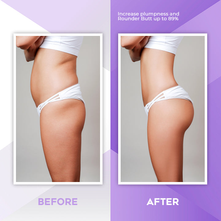 PerfectButt™ Hip Enhancing Essential Oil