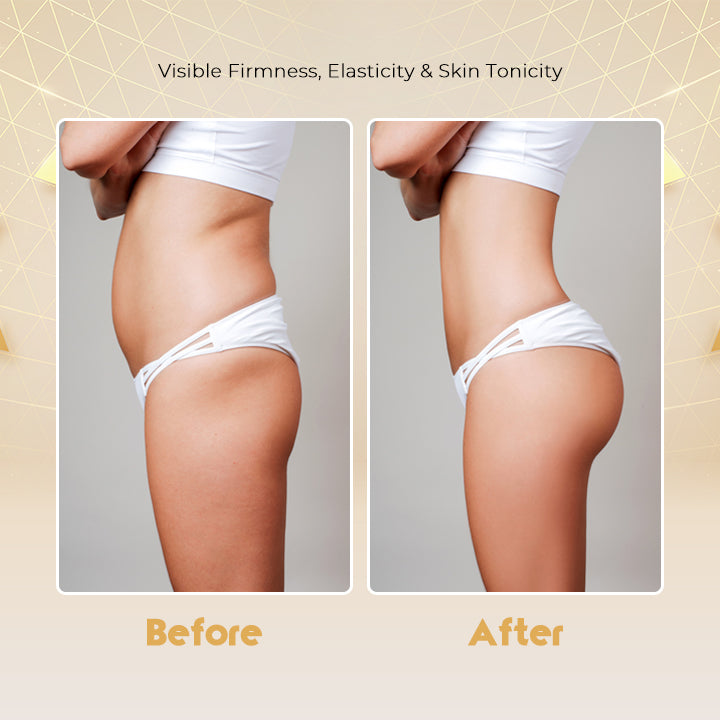 Body Slimming Ginger Roller