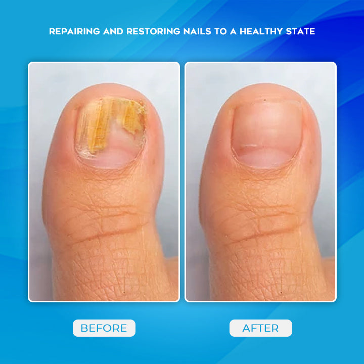 Herbaceous Nail Treatment Essence