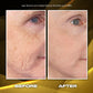 Face Firming Capsule Mask