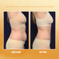 Fat Burning Detox Tummy Patch