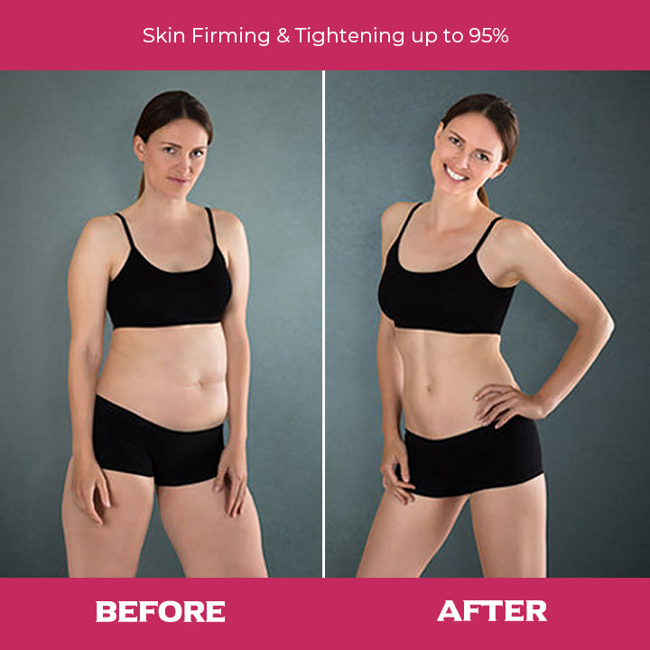 Fat Burning Slimming Cream