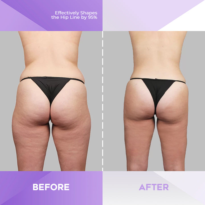 PerfectButt™ Hip Enhancing Essential Oil