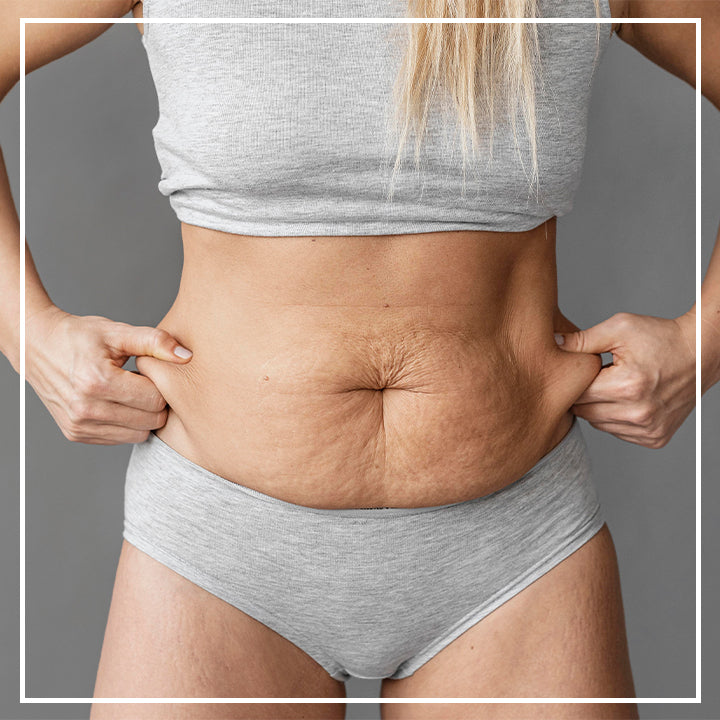 Body Slimming Ginger Roller