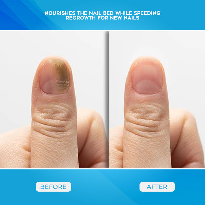 Herbaceous Nail Treatment Essence
