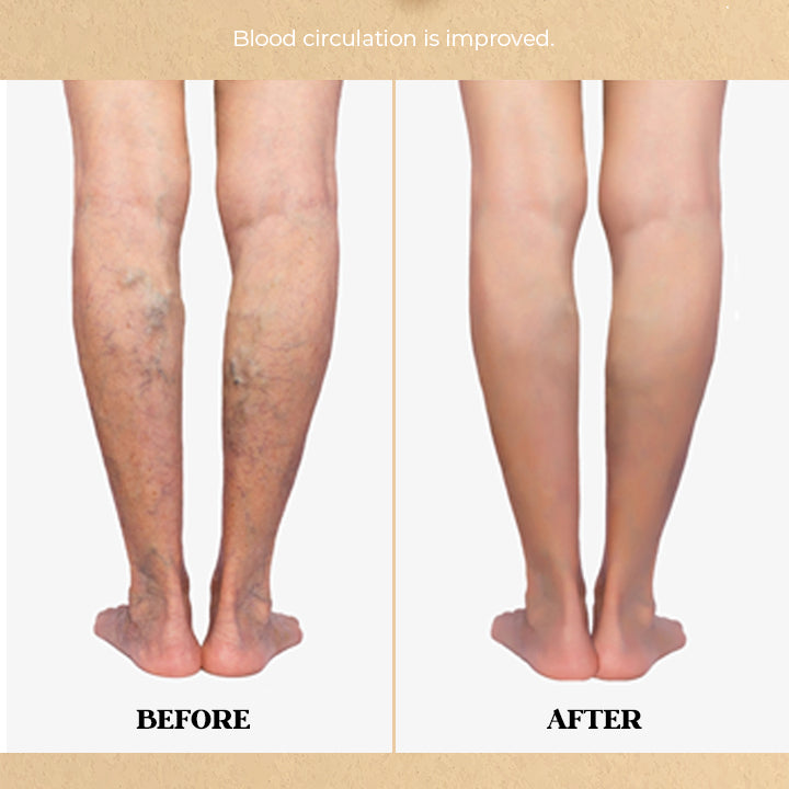 Anti-Swelling Herbal Massage