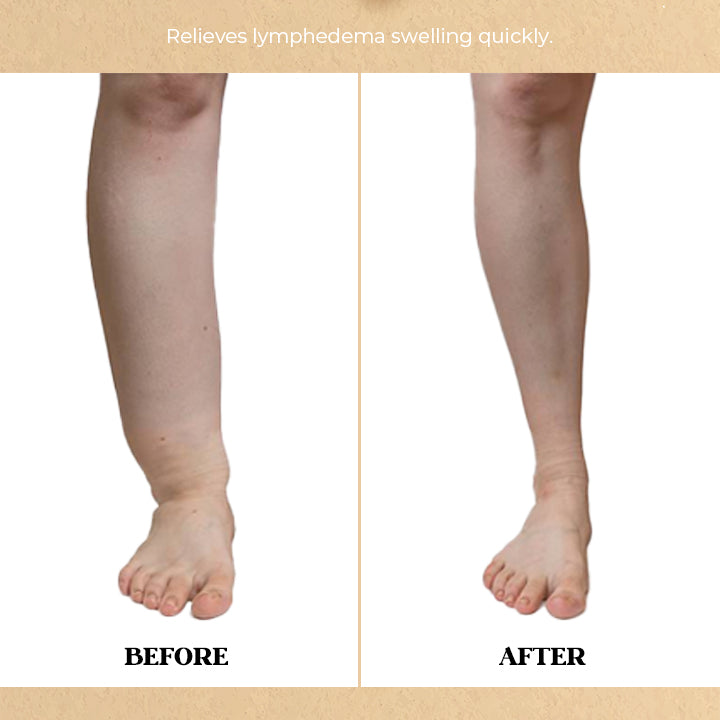 Anti-Swelling Herbal Massage