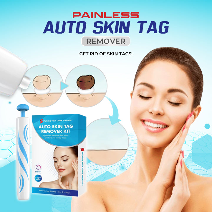 Painless Auto Skin Tag Remover