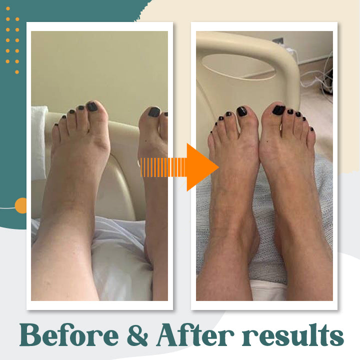 Herbal Anti-Swelling Massage Oil