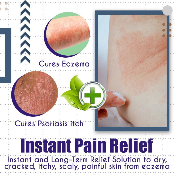 LaCure™ Eczema Calming Cream