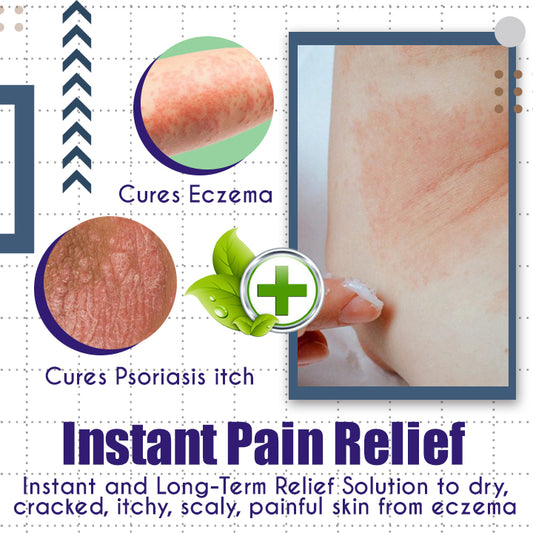 LaCure™ Eczema Calming Cream