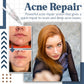 Hyaluronic Acid Skin Repair Essence (2pcs)