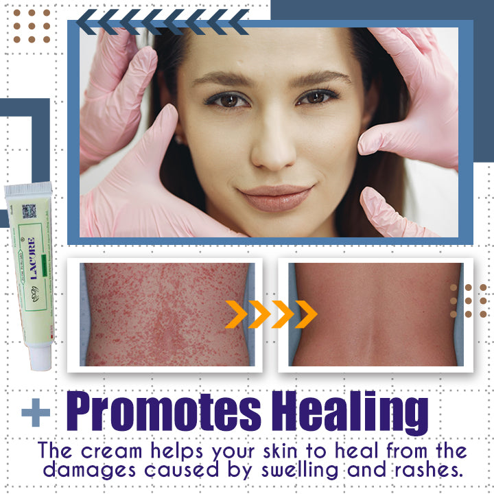 LaCure™ Eczema Calming Cream