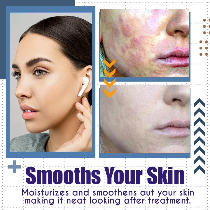 LaCure™ Eczema Calming Cream