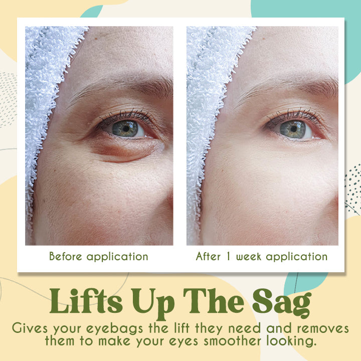 AvoCare™ Brightening Eye Patches