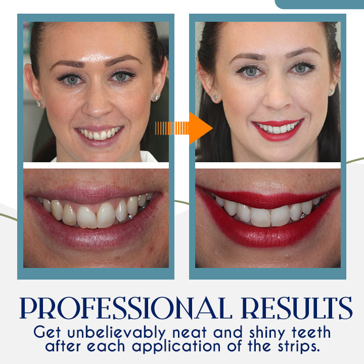 BrightSmile™ 3D Teeth Whitening Strips