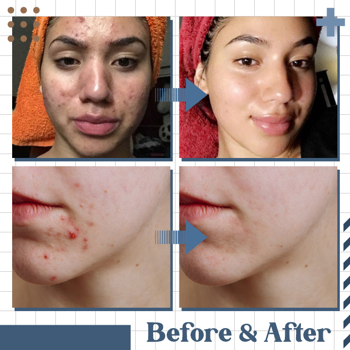 Hyaluronic Acid Skin Repair Essence (2pcs)