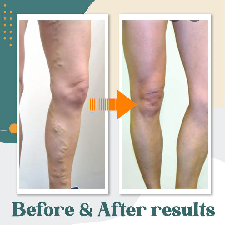Herbal Anti-Swelling Massage Oil