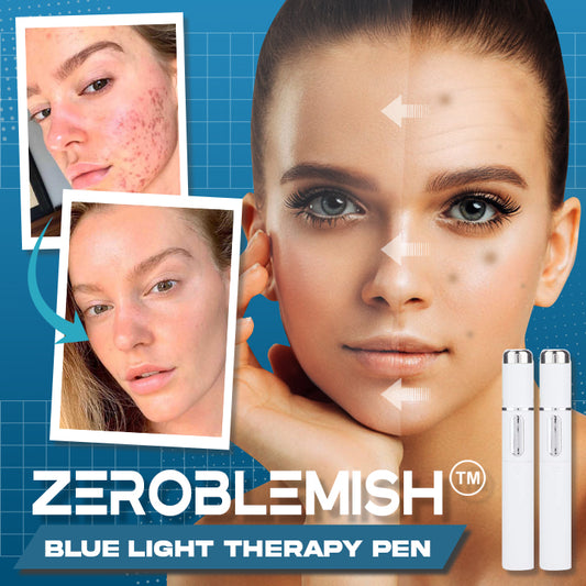 ZeroBlemish™ Blue Light Therapy Pen