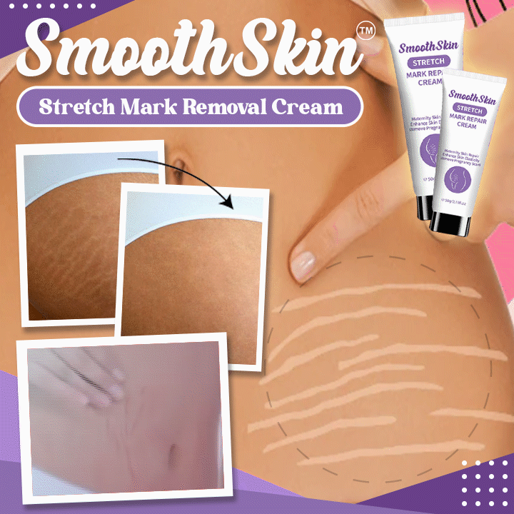 SmoothSkin™ Stretch Mark Removal Cream